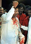 A bleeding protester speaks to journalists after being beaten up by the police in Chennai on Monday.