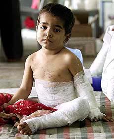 A child who was injured in communal riots