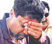 Blood oozes out as Kapil Dev holds his injured forehead. 