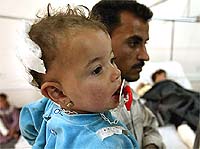 An Iraqi holds his wounded daughter