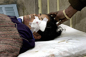 A woman lies in a hospital after she was injured in a grenade explosion in Srinagar on Thursday.