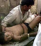 Muhit, a boy from Ahmedabad, is transported into a hospital in Srinagar after he was injured in a grenade blast in a Pahalgam hotel on Saturday.
