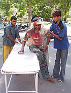 One of the injured farmers is helped on to a stretcher