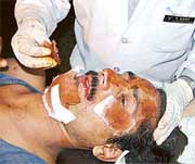 A doctor tends to an injured policeman inside a hospital in Jammu on Friday. 