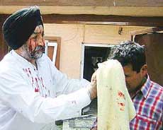 Lending a helping hand: a blast victim attends to another injured person at Gogjibagh locality of Srinagar where militants on Wednesday detonated an explosive-laden car killing one and injuring several persons. 