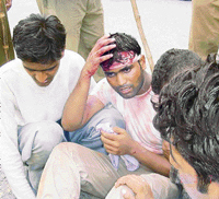 One of those injured sits with a bandaged head after violent workers were lathi-charged in Gurgaon on Monday.