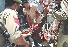 Police personnel carry one of their colleagues injured in a grenade attack for treatment in Srinagar on Tuesday.