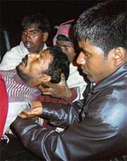 An injured person is brought to Assam Medical College Hospital in Dibrughar on Saturday following a militant attack which left 26 persons dead. 