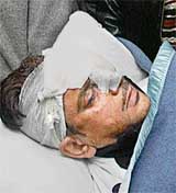 Gurdas Mann in bandages after the accident