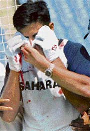 Indian captain Rahul Dravid holds a towel after being hit by a ball in the face during net practice on the fourth day of a five-day conditioning camp at Eden Gardens in Kolkata