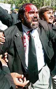 An injured lawyer is helped by his colleagues during a clash with police in Islamabad on Saturday.