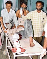 One of the injured at a hospital in Ludhiana