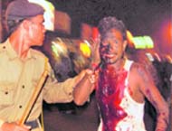 A policeman takes an injured to the hospital