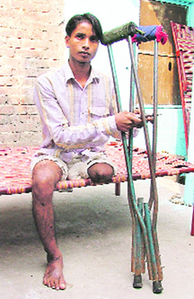 Pawan Kumar, who lost his leg in Shingar blast in Ludhiana, a year ago.