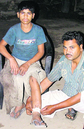 Mehraz, a Shingar blast victim, whose wounds have still not healed.