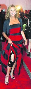 BRACING UP: Actor Lauren Hutton shows off a leg brace and dress designed by Michael Kors