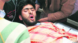 An injured being carried to a hospital in Srinagar on Monday.