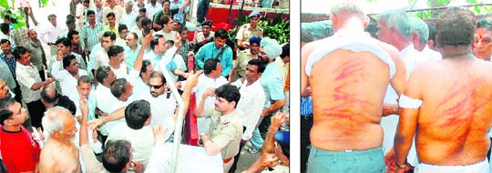 Residents and family members of alleged victims block the main gate of the Phase I Industrial Area police station; and (right) victims show their wounds on their backs after the “clash” in Chandigarh on Sunday.