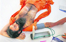 Doctors attend to yoga guru Ramdev on Friday.