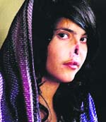 Aisha from Afghanistan, who had fled from abusive in-laws. The Taliban cut off her ears and nose