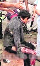 A TV grab of an injured person sitting outside the Delhi High Court on Wednesday.
