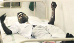 A person injured in the fire being treated at a hospital in Mumbai