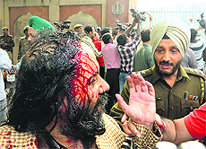 SAD (Badal) Delhi president Manjit Singh injured in the attack