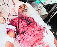Major Singh, a SAD worker, who was injured in firing in an Amritsar village on Friday