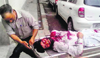 An injured being taken to a hospital after the grenade attack in Srinagar on Wednesday. Tribune photo: Amin War