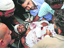 A man injured in a clash at Ramban being taken to a hospital