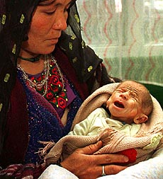 KABUL : Four-month-old Aminullah at Indira Gandhi Hospital in Kabul who is struggling for survival as international aid groups have pulled out of the capital city rather than follow rules imposed by the Taliban army — AP/PTI