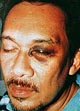 A close-up photo of jailed former Deputy Prime Minister Anwar Ibrahim 