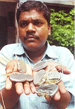 Kolkata: A mediacal bank volunteer holds pace-makers, recovered from dead bodies, for the treatment of the poor patients.