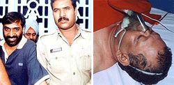 General secretary of the MP Congress, Inder Prajapat (left), who shot at another party general secretary Manak Agarwal (right), lying at Hamidia Hospital in Bhopal on Sunday.