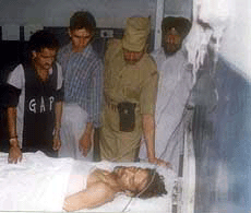 One of the injured of the Kishtwar massacre.