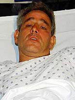 New York firefighter Robert Pesce, of Staten Island, N.Y., is interviewed at Bellevue Hospital in New York on Wednesday. 