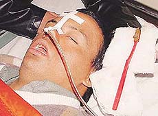Anil Kumar