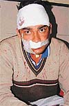 Stundent Jasjit Singh hurt in a clash on the Panjab University Campus on Friday.