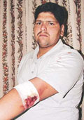 Gopal Krishan, who was injured at Fun City, near Panchkula, on Sunday.
