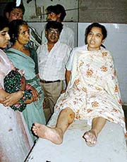 An unidentified victim injured during a bomb blast speaks to the media