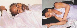 Two migrant labourers lie unconscious in the Civil Hospital