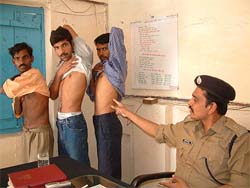 The hapless migrants who sold their kidneys
