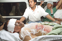A bomb blast victim is loaded into an ambulance