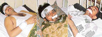 Three of the four persons, who were injured in a roof collapse, recuperate at Civil Hospital