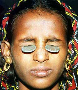 A Rajasthani folk dancer lifts coins from the ground with her eyelids