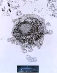 A virus-infected cell is inspected under a microscope