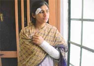 Prabhjit Kaur, who was injured in a powerful LPG cylinder blast that took place at her residence in Preet Nagar