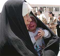 An Iraqi mother carries her wounded baby at the military airport of Kuwait 