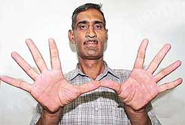 Satish Kumar Yadav 
