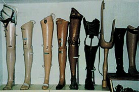 Artificial lower limbs